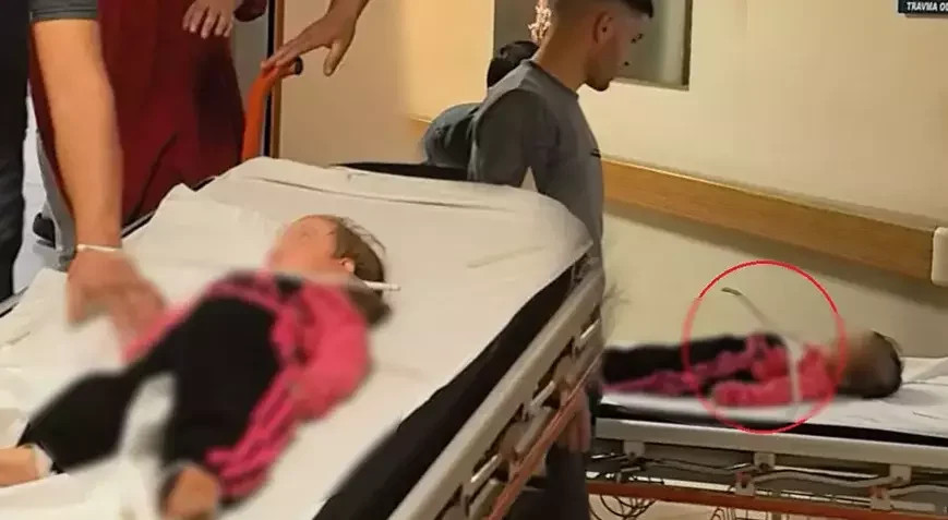 2 Yaşındaki Çocuğun Çenesine Askı Saplandı