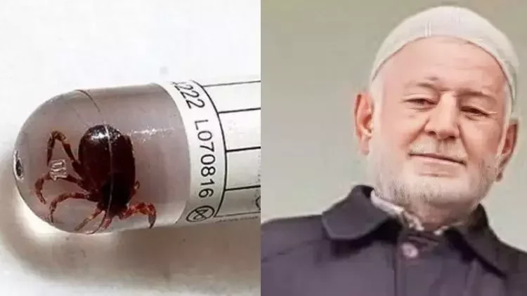 Koltuk Altına Kene Yapışan Yaşlı Adam Hayatını Kaybetti